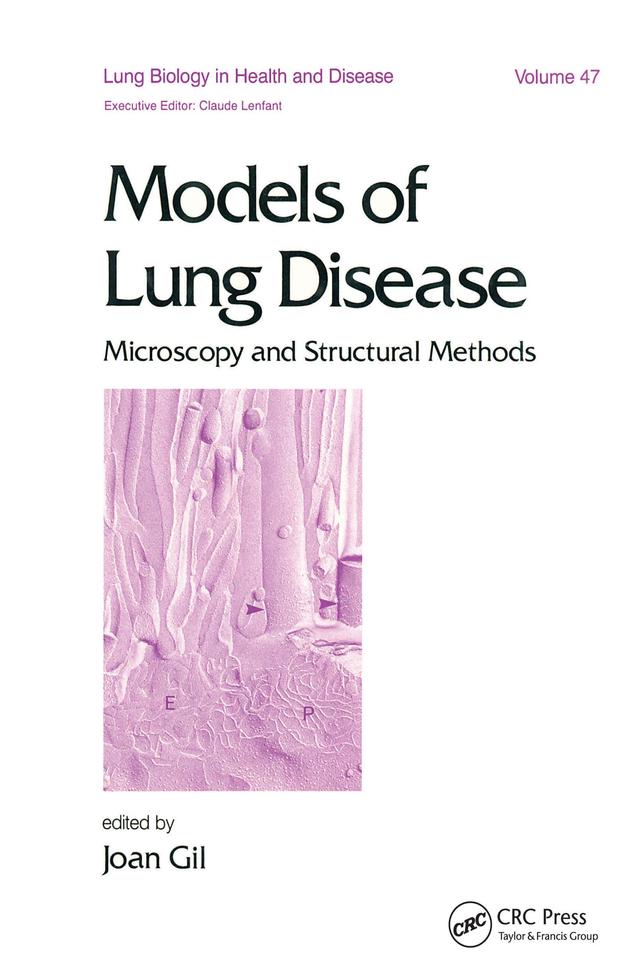 Models of Lung Disease by Joan Gil