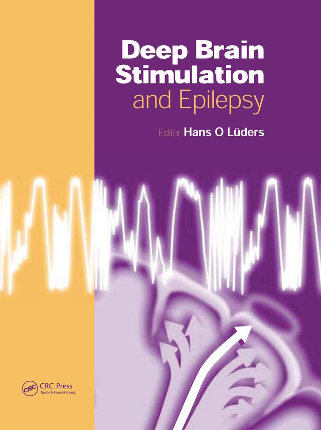 Deep Brain Stimulation and Epilepsy by Hans O. Lüders