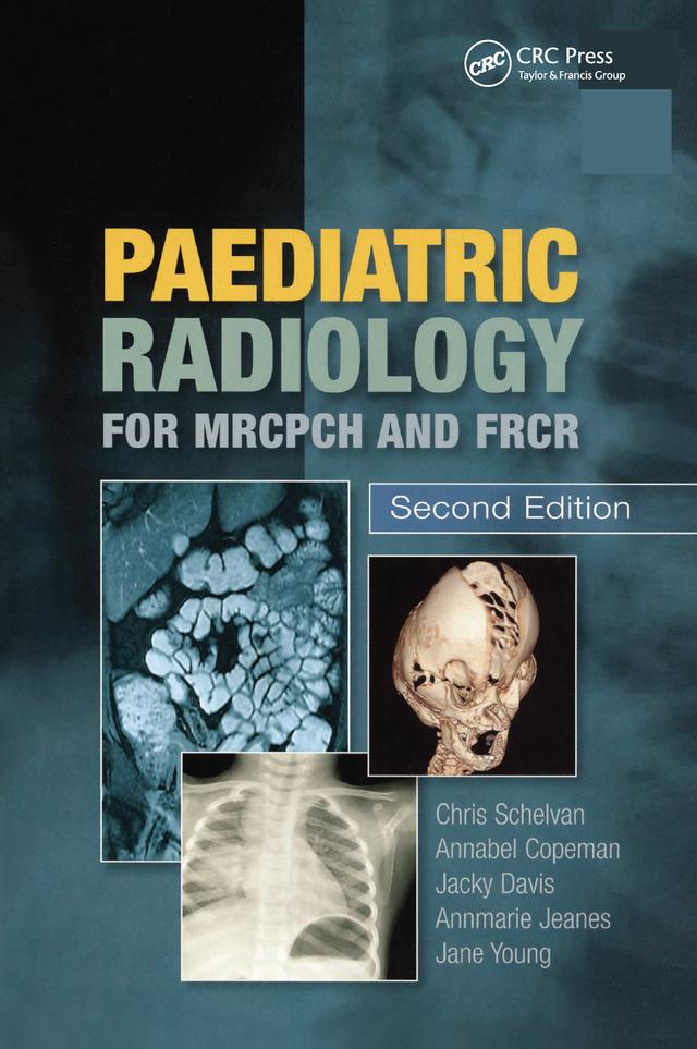 Paediatric Radiology for MRCPCH and FRCR, Second Edition by Annmarie Jeanes, Christopher Schelvan, Copeman Copeman, Jacqueline Davis, Jane Young