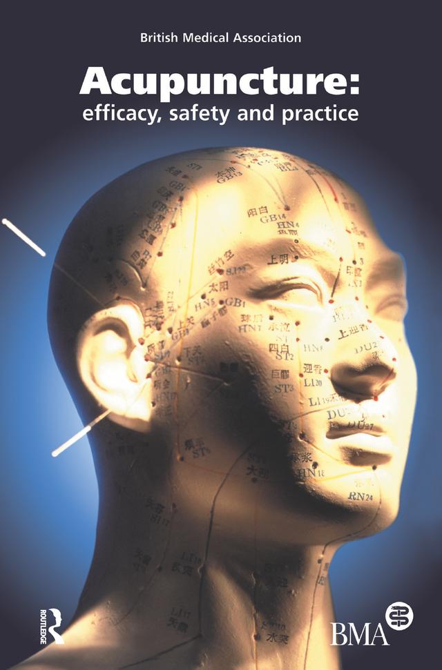 Acupuncture by British Medical Association