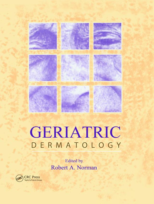Geriatric Dermatology by R.A. Norman