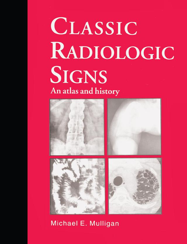 Classic Radiologic Signs by M.E. Mulligan