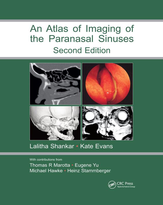 Atlas of Imaging of the Paranasal Sinuses, Second Edition by Kathryn Evans, Lalitha Shankar