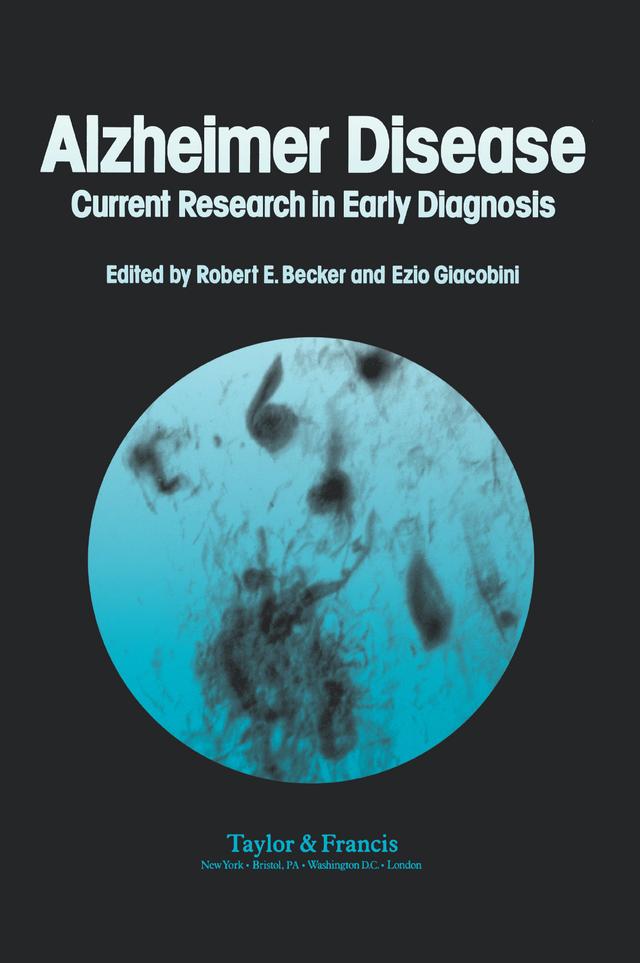 Alzheimer's Disease by Robert Becker