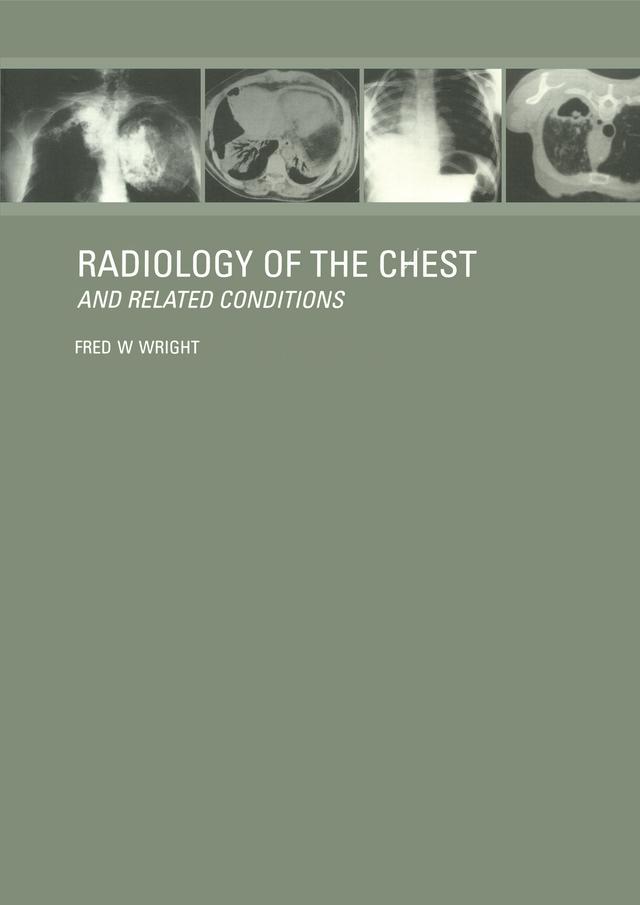 Radiology of the Chest and Related Conditions by F W Wright