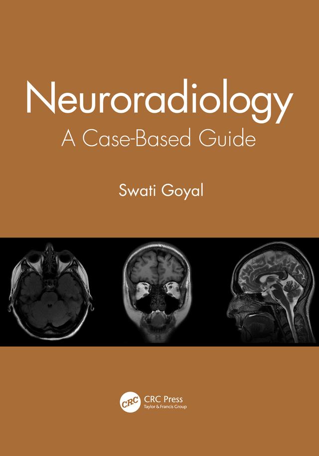 Neuroradiology by Swati Goyal