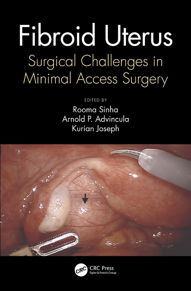 Fibroid Uterus by Arnold Advincula, Kurian Joseph, Rooma Sinha