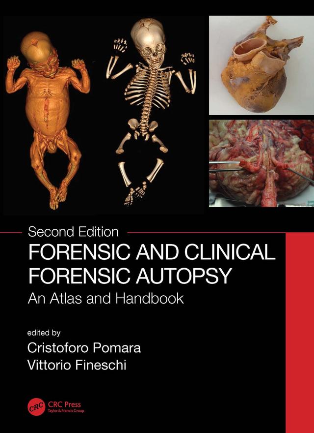 Forensic and Clinical Forensic Autopsy by Cristoforo Pomara, Vittorio Fineschi