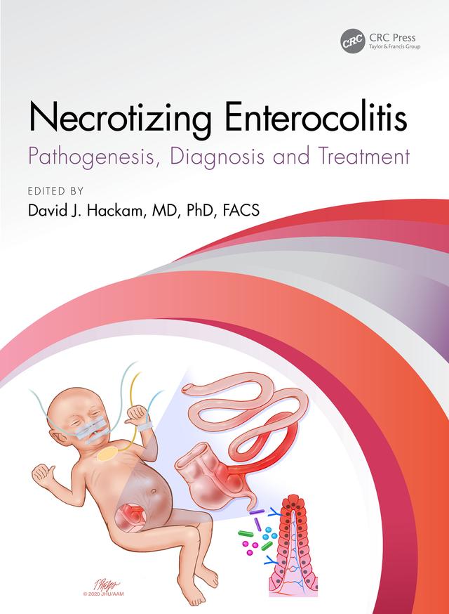 Necrotizing Enterocolitis by David J. Hackam