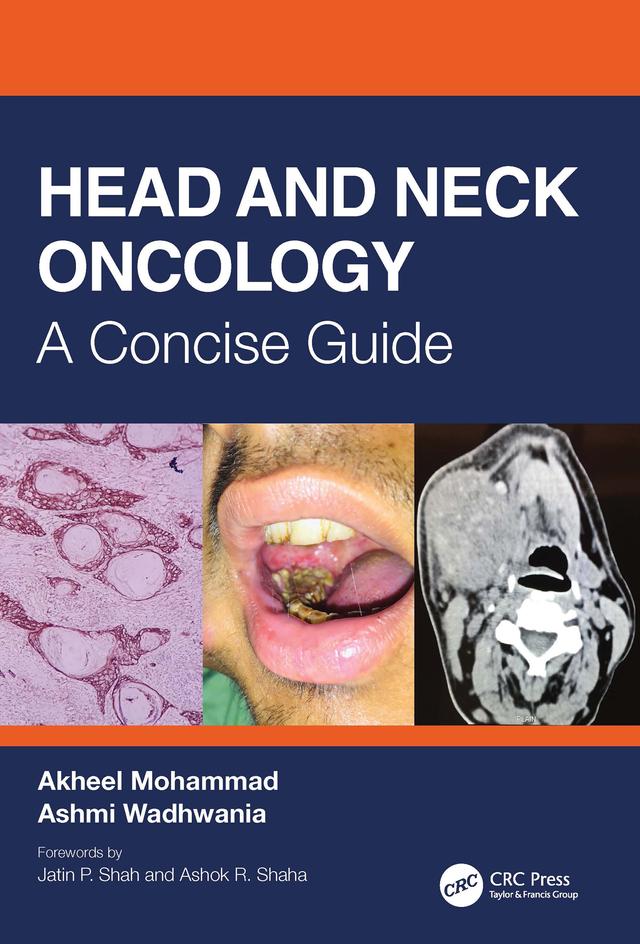 Head and Neck Oncology by Akheel Mohammad, Ashmi Wadhwania