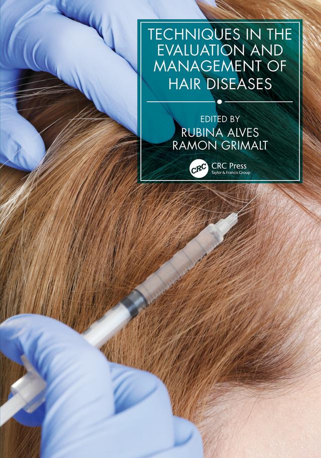 Techniques in the Evaluation and Management of Hair Diseases by Ramon Grimalt, Rubina Alves