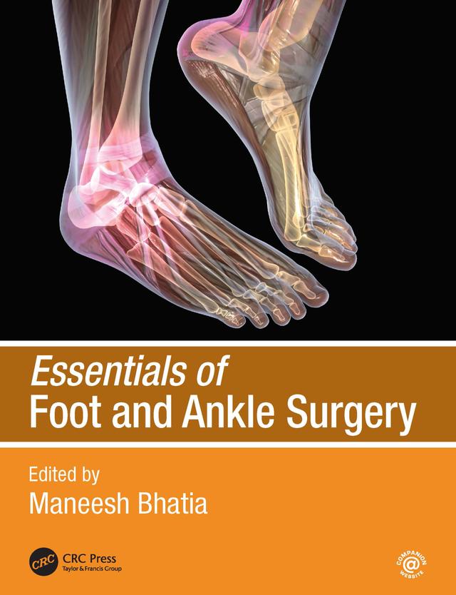 Essentials of Foot and Ankle Surgery by Maneesh Bhatia