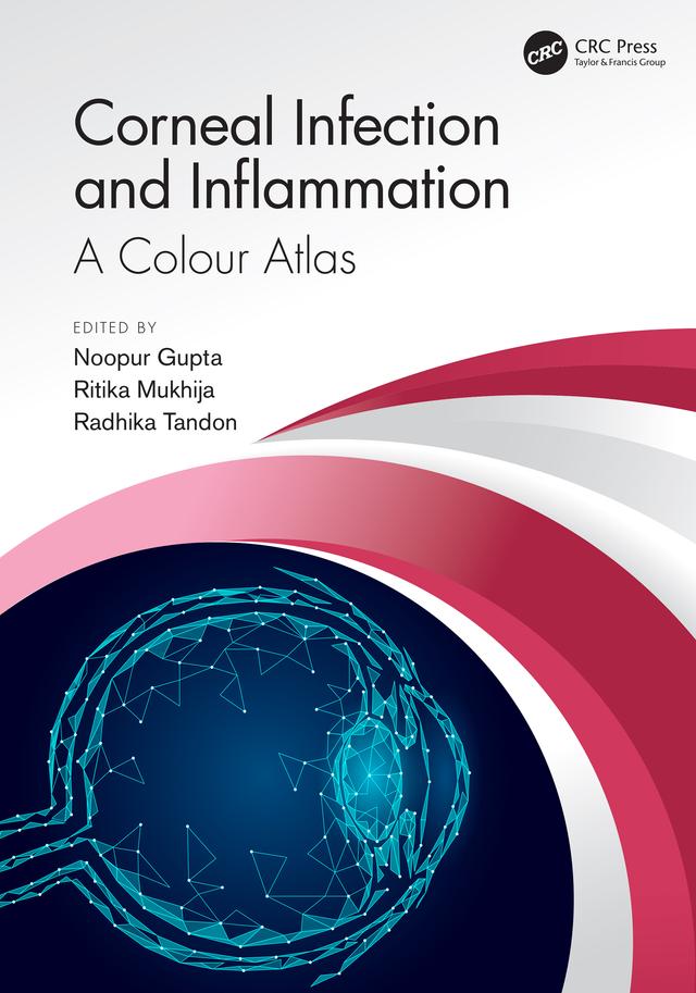Corneal Infection and Inflammation by Noopur Gupta, Radhika Tandon, Ritika Mukhija