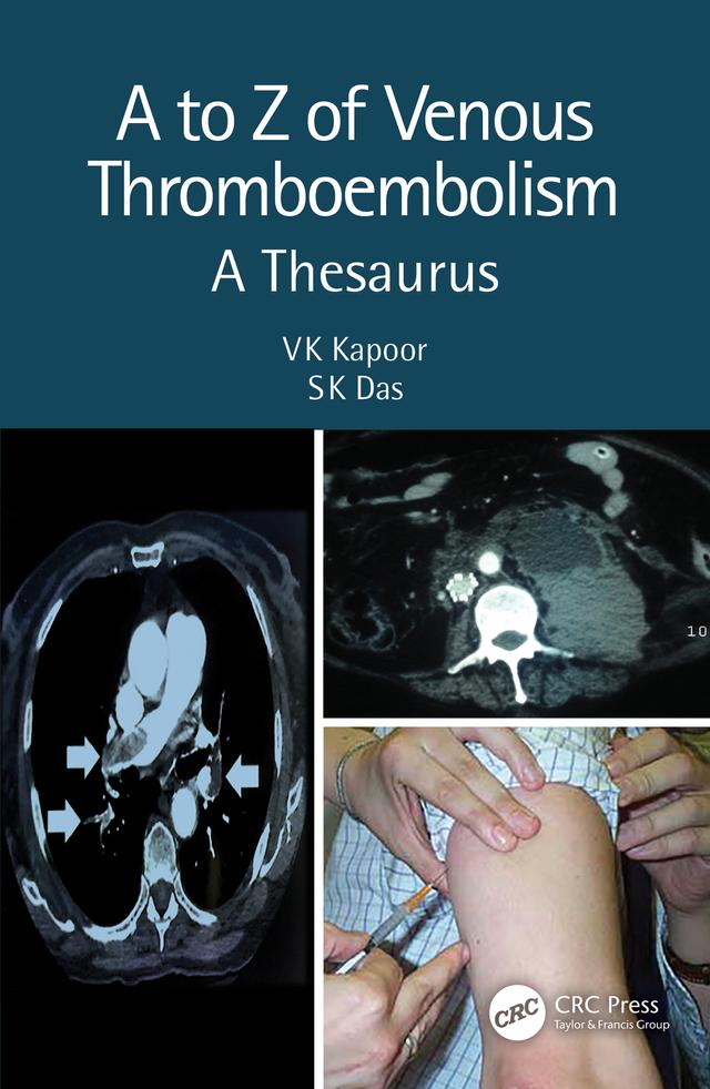 A to Z of Venous Thromboembolism by SK Das, VK Kapoor
