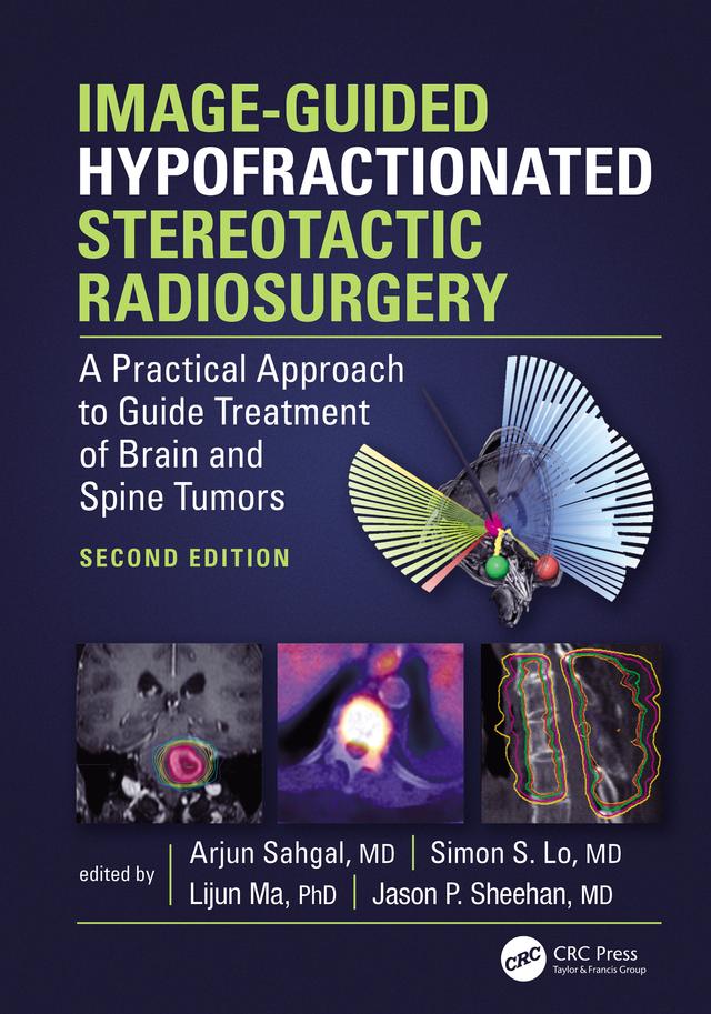 Image-Guided Hypofractionated Stereotactic Radiosurgery by Arjun Sahgal
