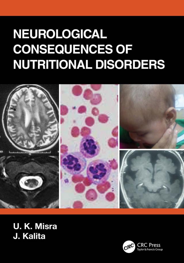 Neurological Consequences of Nutritional Disorders by J. Kalita, U. K. Misra