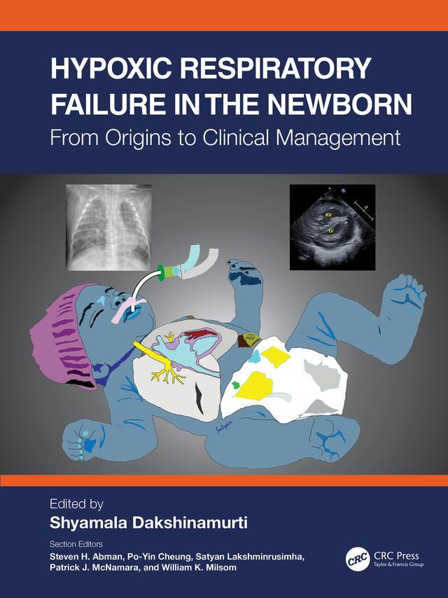 Hypoxic Respiratory Failure in the Newborn by Shyamala Dakshinamurti