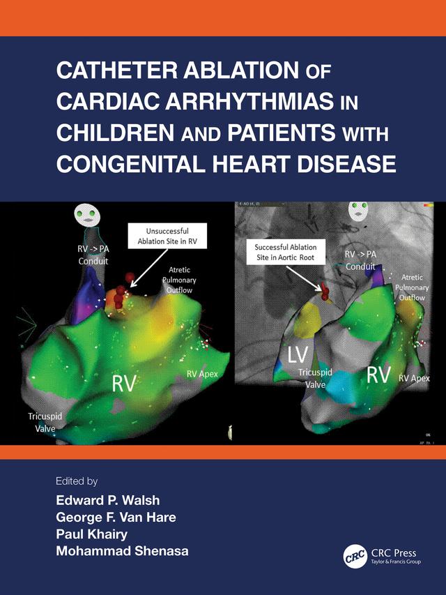 Catheter Ablation of Cardiac Arrhythmias in Children and Patients with Congenital Heart Disease by Edward P. Walsh, George F. Van Hare, Mohammad Shenasa, Paul Khairy