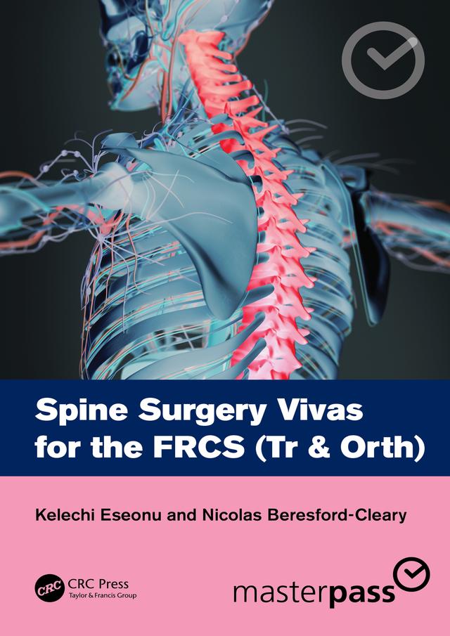 Spine Surgery Vivas for the FRCS (Tr & Orth) by Kelechi Eseonu, Nicolas Beresford-Cleary