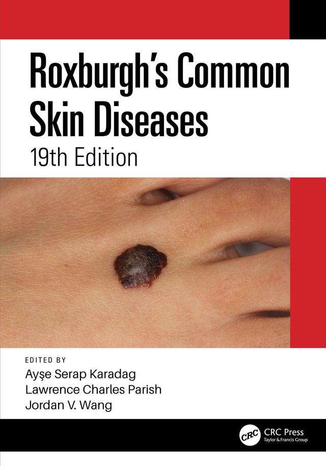 Roxburgh's Common Skin Diseases by Ayşe Serap Karadag, Jordan V. Wang, Lawrence Charles Parish