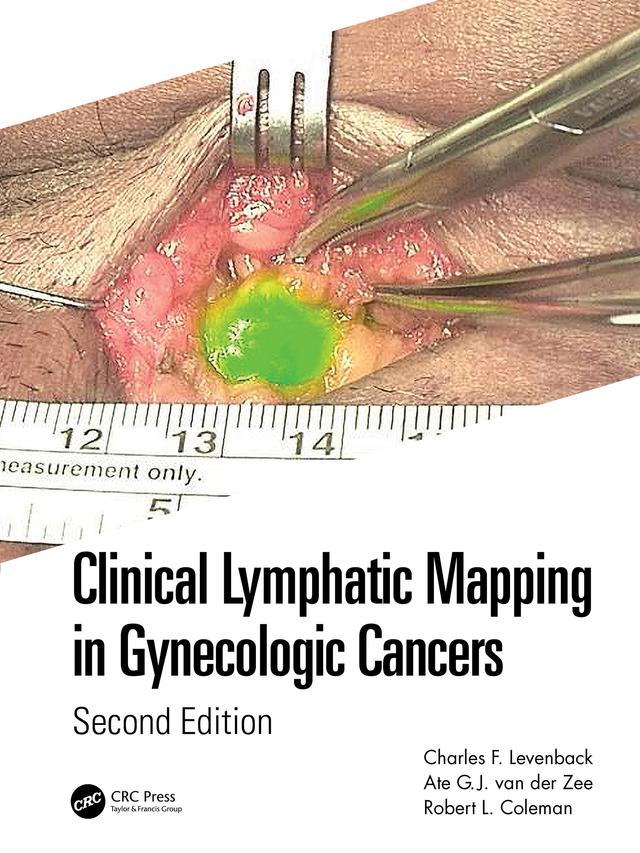 Clinical Lymphatic Mapping in Gynecologic Cancers by Ate GJ van der Zee, Charles Levenback, Robert L. Coleman