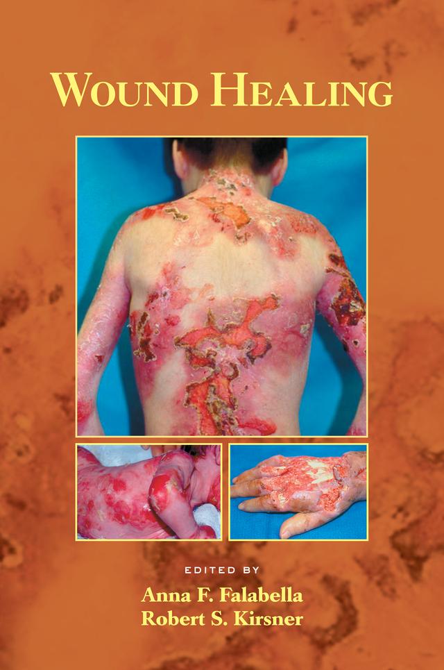 Wound Healing by Anna Falabella, Robert Kirsner