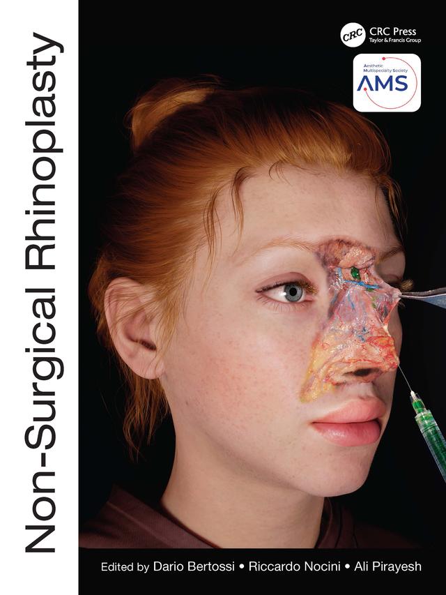 Non-Surgical Rhinoplasty by Ali Pirayesh, Dario Bertossi, Riccardo Nocini