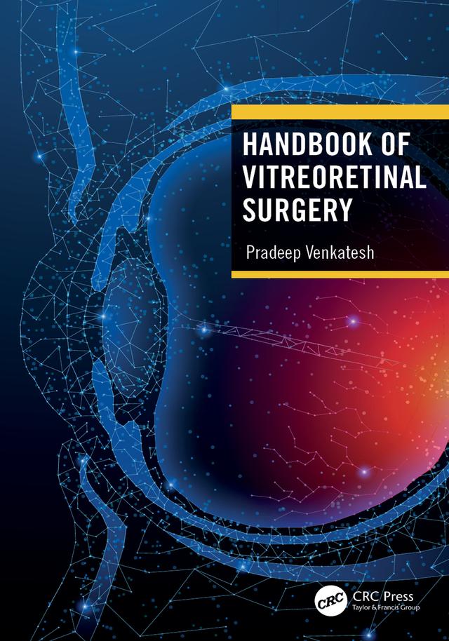 Handbook of Vitreoretinal Surgery by Pradeep Venkatesh
