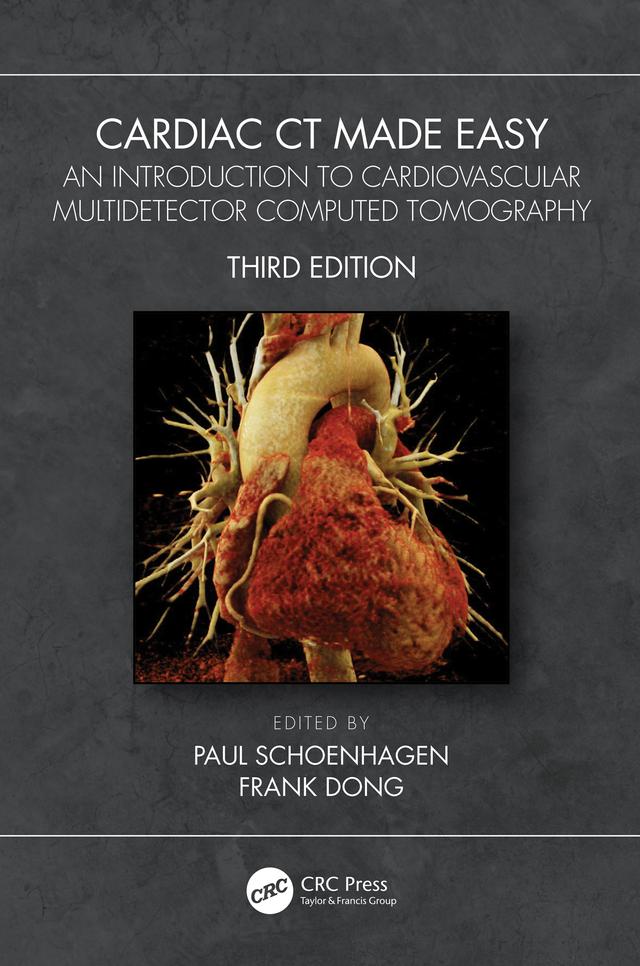 Cardiac CT Made Easy by Frank Dong, Paul Schoenhagen