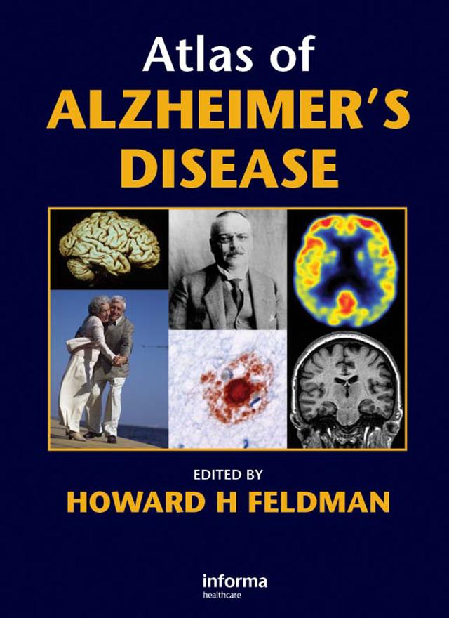 Atlas of Alzheimer's Disease by Howard Feldman