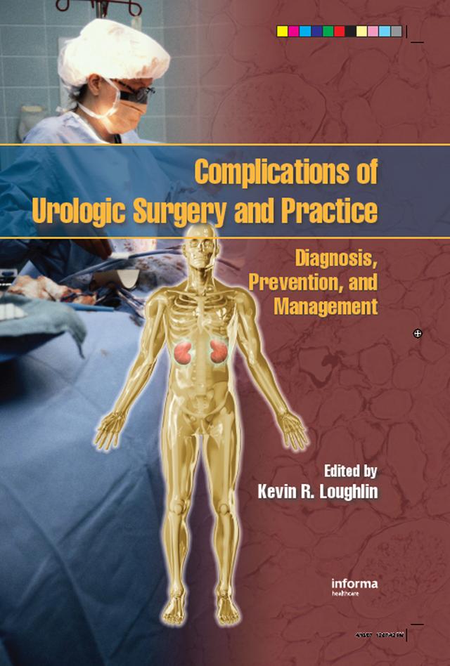 Complications of Urologic Surgery and Practice by Kevin R. Loughlin