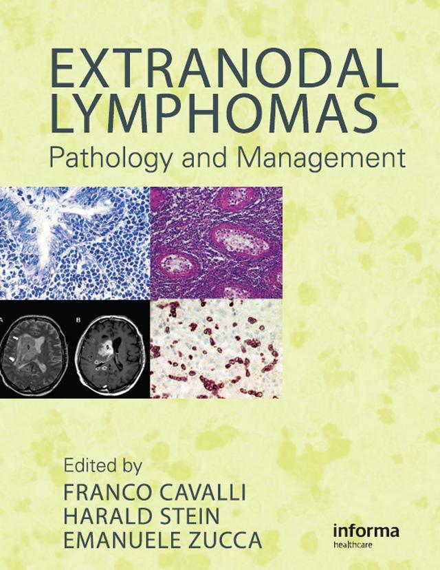 Extranodal Lymphomas by Emanuele Zucca, Franco Cavalli, Harald Stein