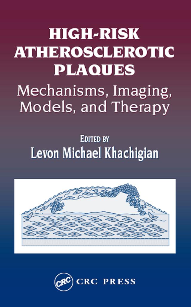 High-Risk Atherosclerotic Plaques by Levon Michael Khachigian