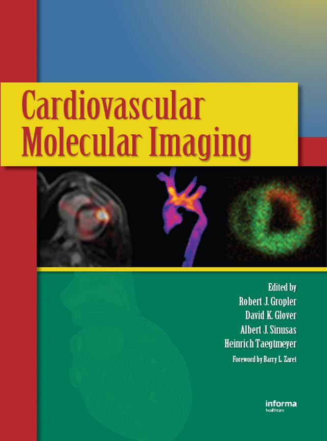 Cardiovascular Molecular Imaging by Albert J. Sinusas, David K. Glover, Robert J. Gropler