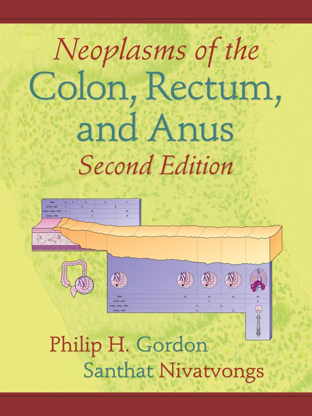 Neoplasms of the Colon, Rectum, and Anus by Philip H. Gordon, Santhat Nivatvongs