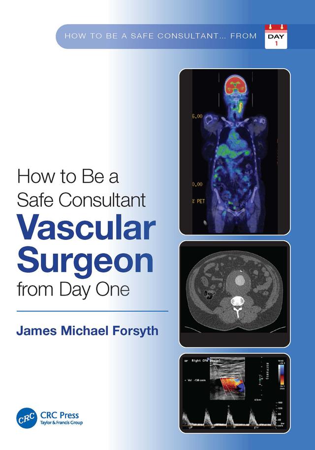 How to be a Safe Consultant Vascular Surgeon from Day One by James Forsyth