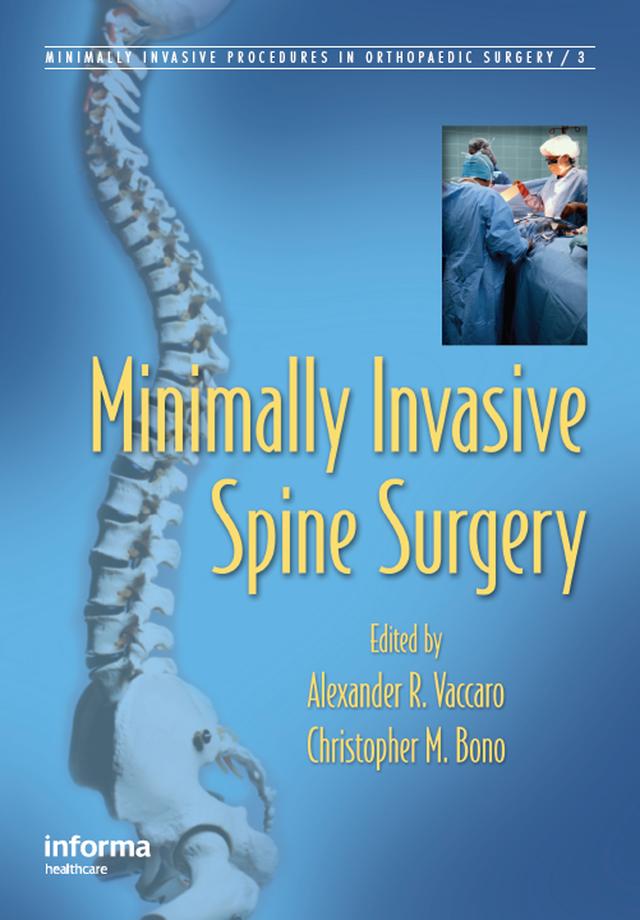 Minimally Invasive Spine Surgery by Alexander R. Vaccaro, Christopher M. Bono