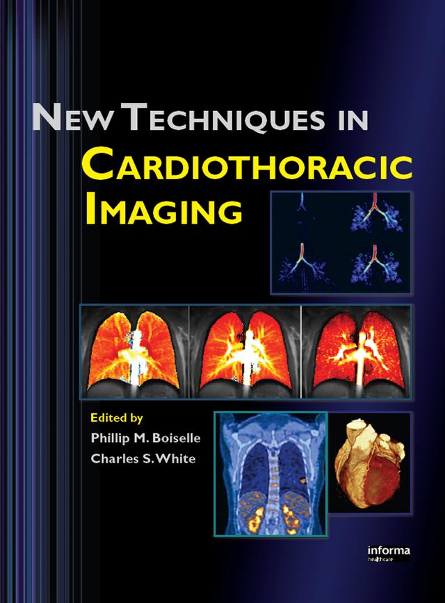 New Techniques in Cardiothoracic Imaging by Charles S. White, Phillip M. Boiselle