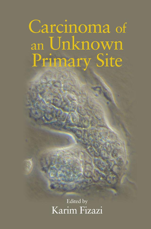 Carcinoma of an Unknown Primary Site by Karim Fizazi