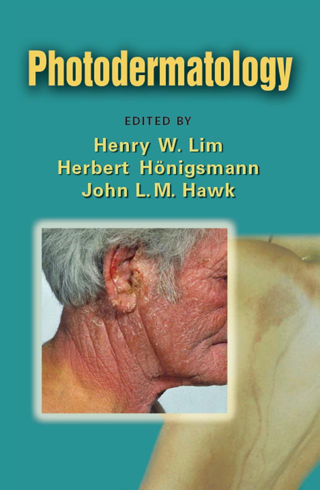 Photodermatology by Henry W. Lim, Herbert Honigsmann, John L. M. Hawk