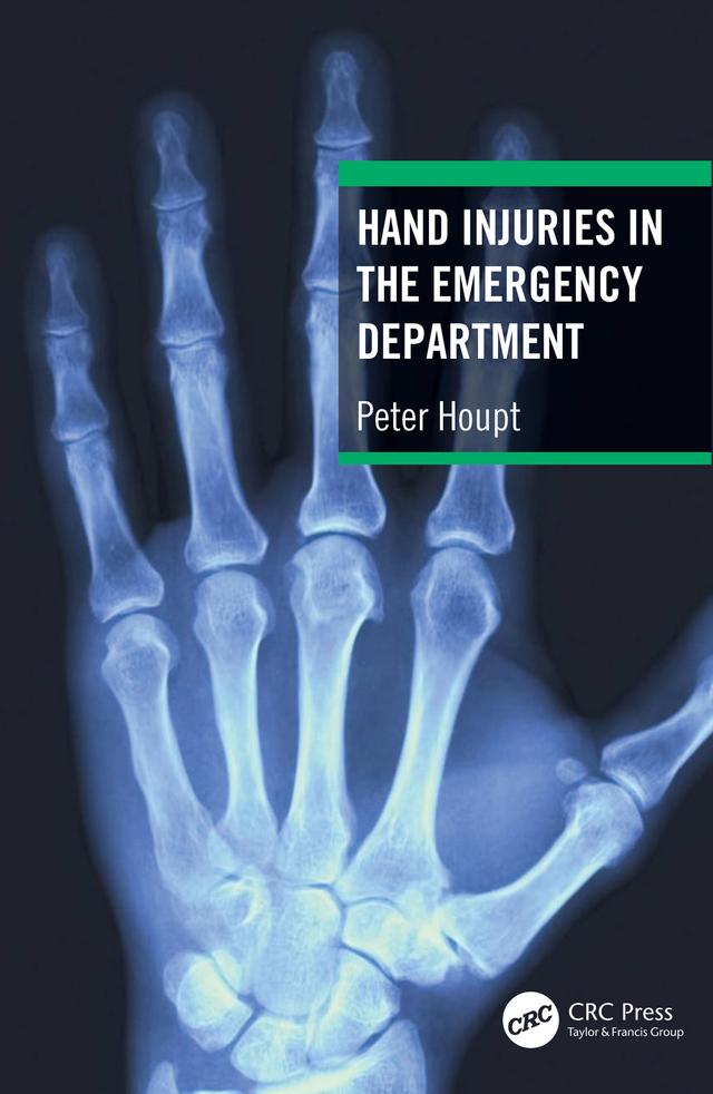 Hand Injuries in the Emergency Department by Peter Houpt