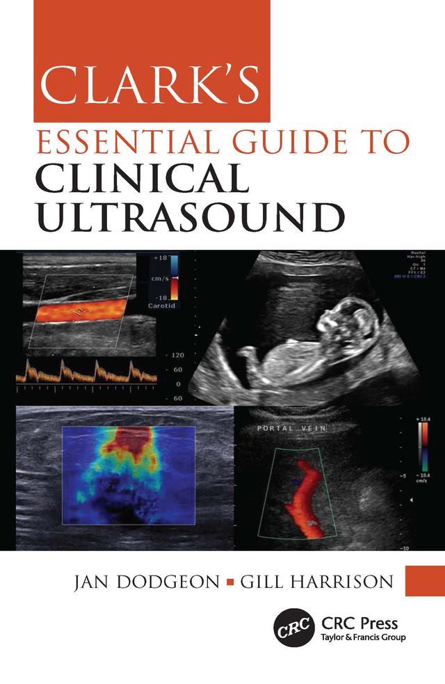 Clark's Essential Guide to Clinical Ultrasound by Gill Harrison, Jan Dodgeon