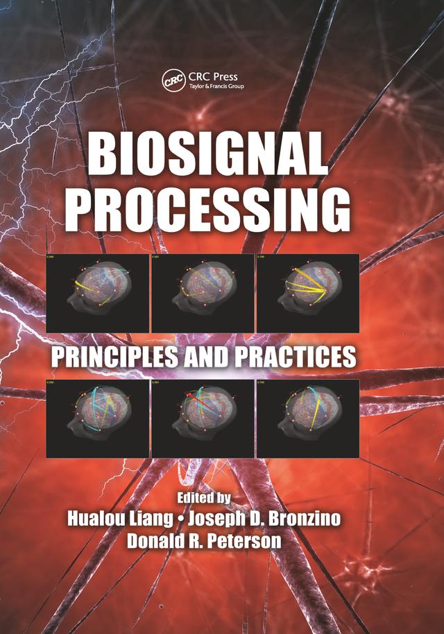 Biosignal Processing by Donald R. Peterson, Hualou Liang, Joseph D. Bronzino