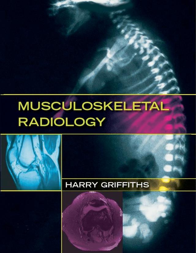 Musculoskeletal Radiology by Harry Griffiths
