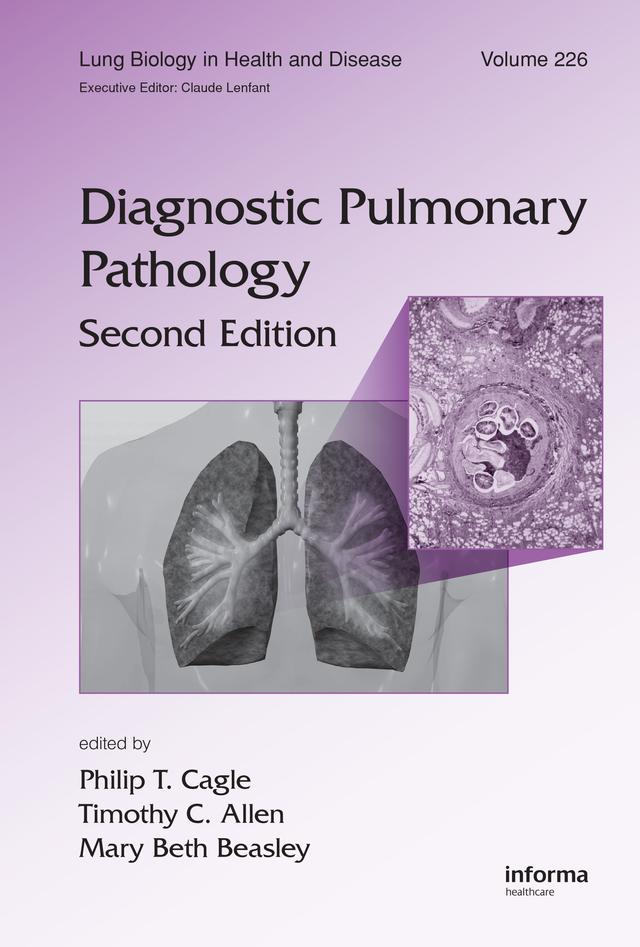 Diagnostic Pulmonary Pathology by Mary Beth Beasley, Philip T. Cagle, Timothy C. Allen