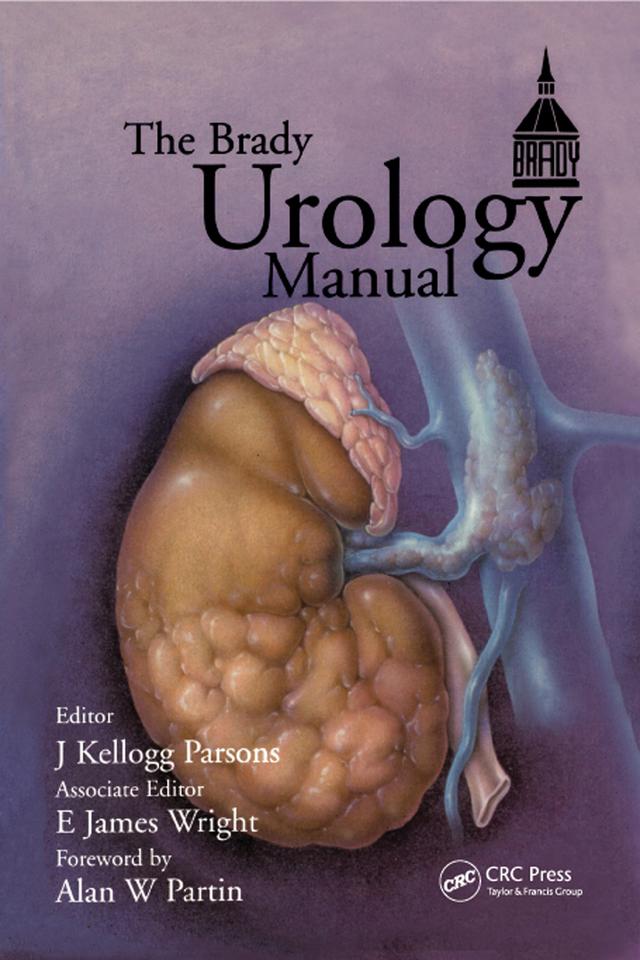 Brady Urology Manual by E. James Wright, J. Kellogg Parsons