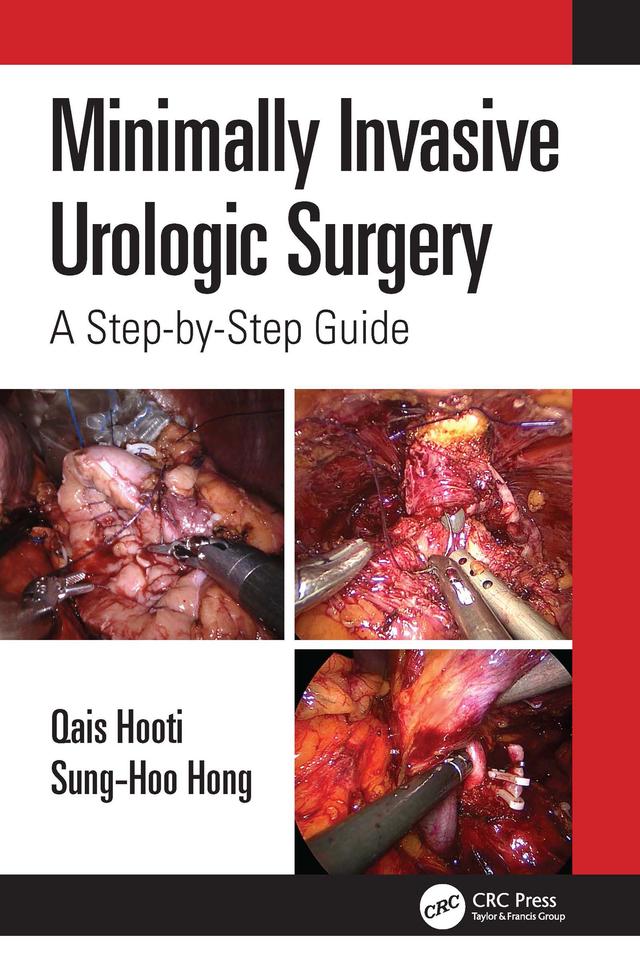 Minimally Invasive Urologic Surgery by Qais Hooti, Sung-Hoo Hong