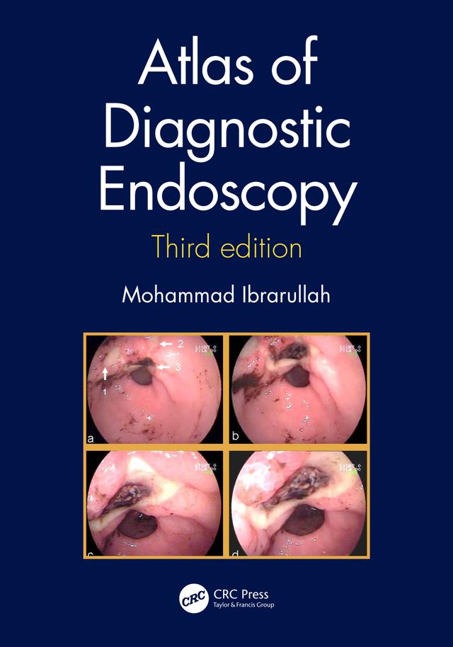 Atlas of Diagnostic Endoscopy, 3E by Mohammad Ibrarullah