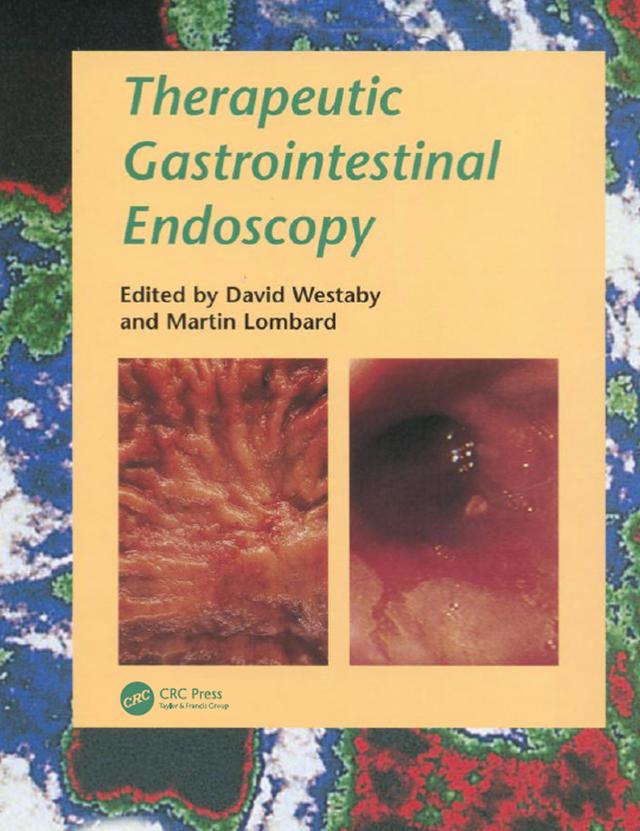 Therapeutic Gastrointestinal Endoscopy by David Westaby, Martin Lombard