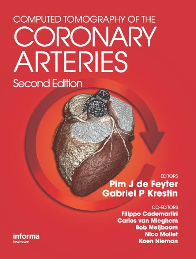 Computed Tomography of the Coronary Arteries by G. P. Gabriel Krestin, Pim J. de Feyter